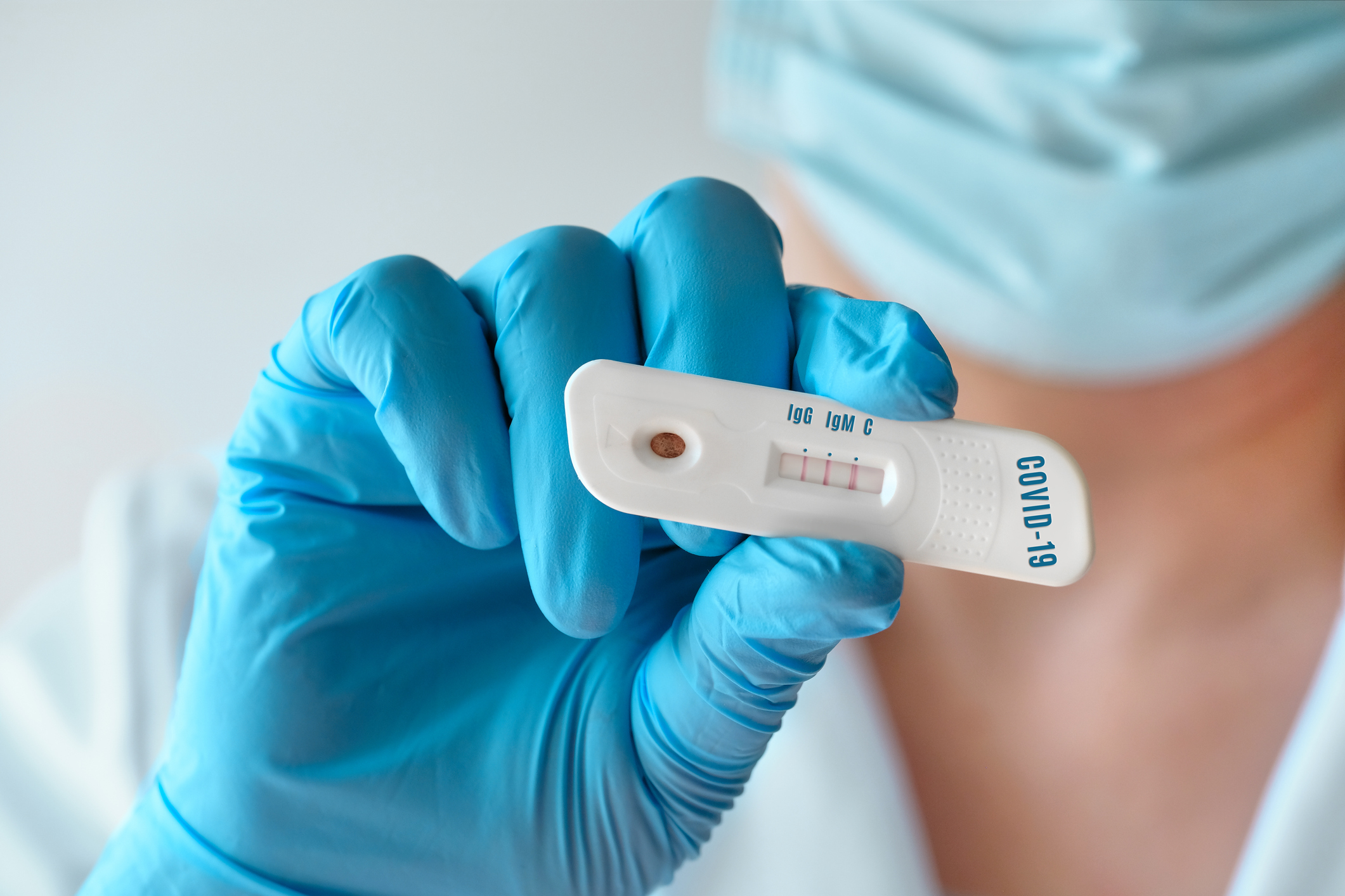 Testes contra Covid-19 identificaram mais de 2 mil casos em quatro bairros de Salvador