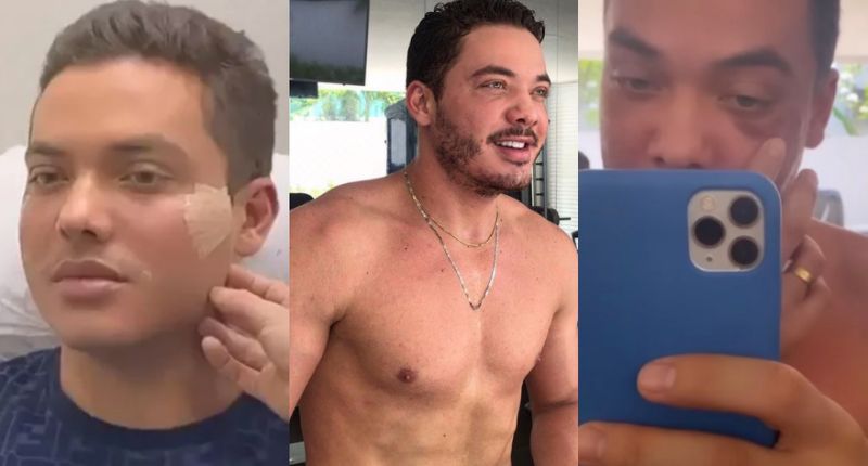 Cantor Wesley Safadão adota kit de procedimentos estéticos e muda visual