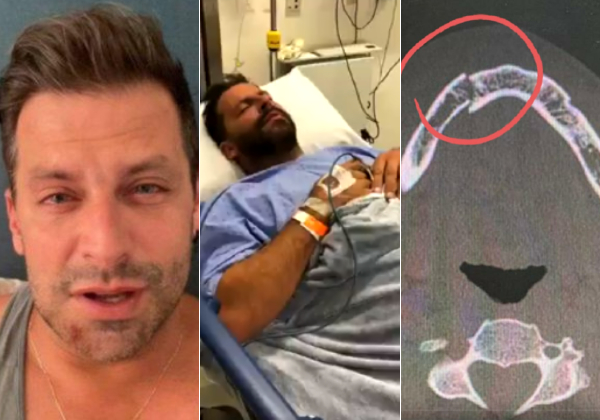 Depois de ter mandíbula fraturada, Henri Castelli chora ao denunciar agressão em Alagoas