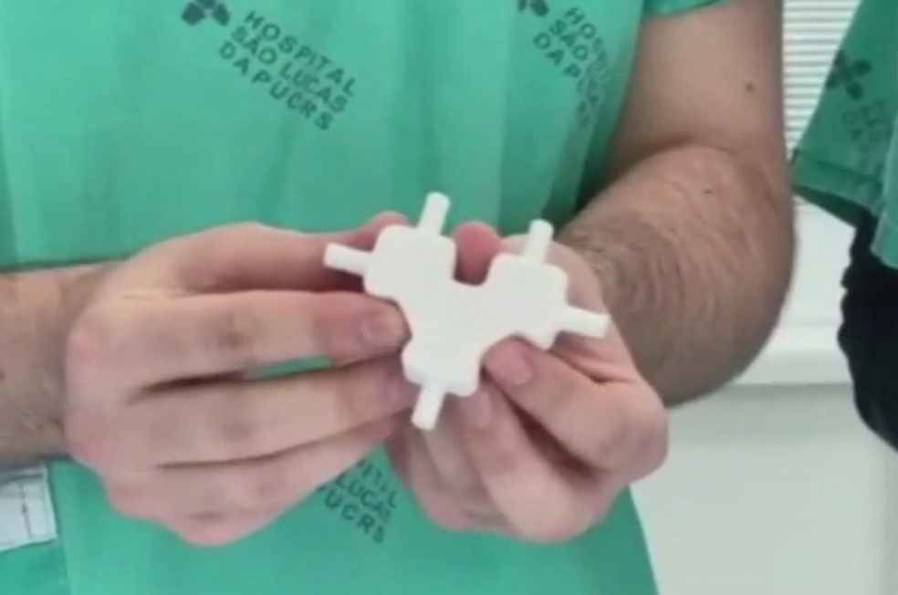 Cateter em 3D reduz necessidade de intubação a pacientes com Covid-19