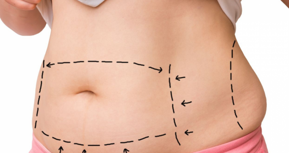 Cirurgias plásticas impactam positivamente a saúde mental, apontam especialistas