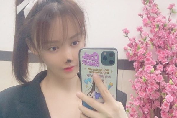 Procedimento estético deixa atriz chinesa com necrose no nariz