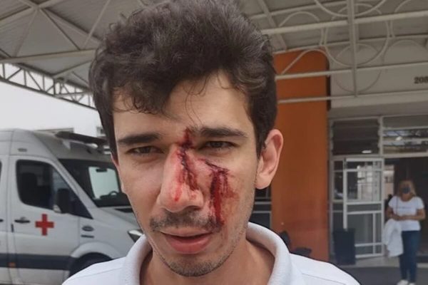 Gerente de mercado pede que cliente coloque máscara e recebe golpe de skate