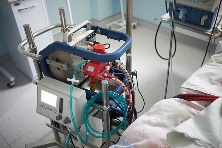 Faltam insumos para a Ecmo, máquina que salva pacientes de Covid