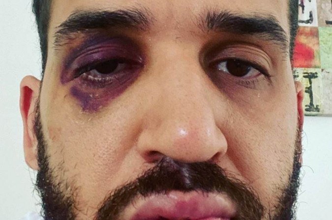 Médico do Paraná é espancado após defender lockdown