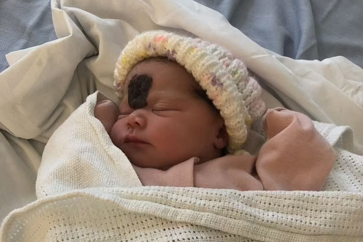 Pais se revoltam após médicos se negarem a retirar mancha na testa de criança