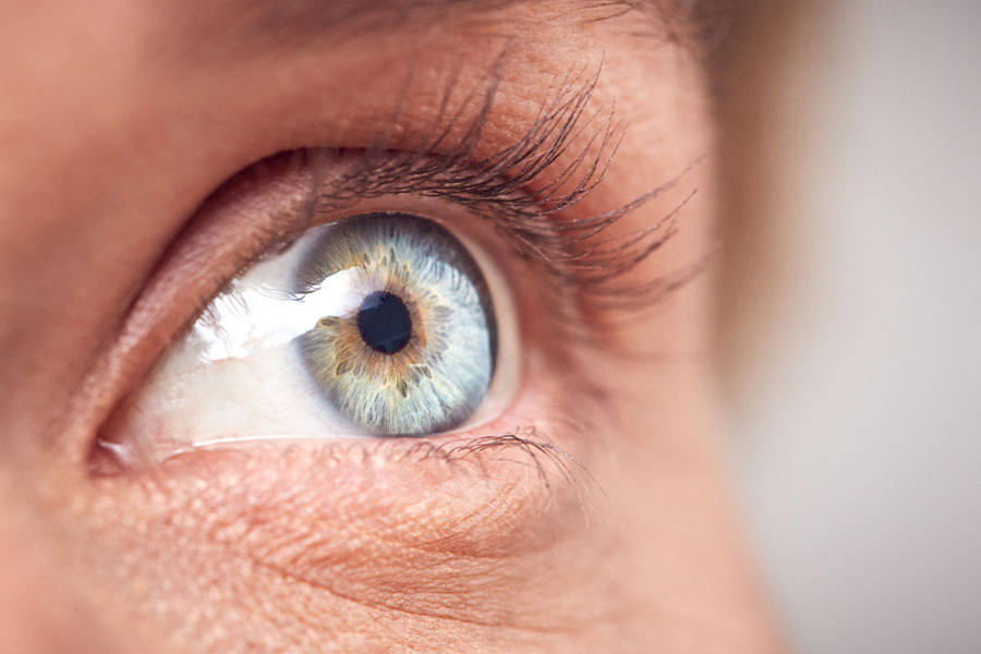 Olhos e boca secos podem ser sintomas da Síndrome de Sjögren