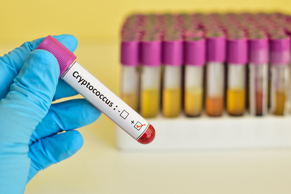 USP participará de rede global para encontrar a cura do HIV