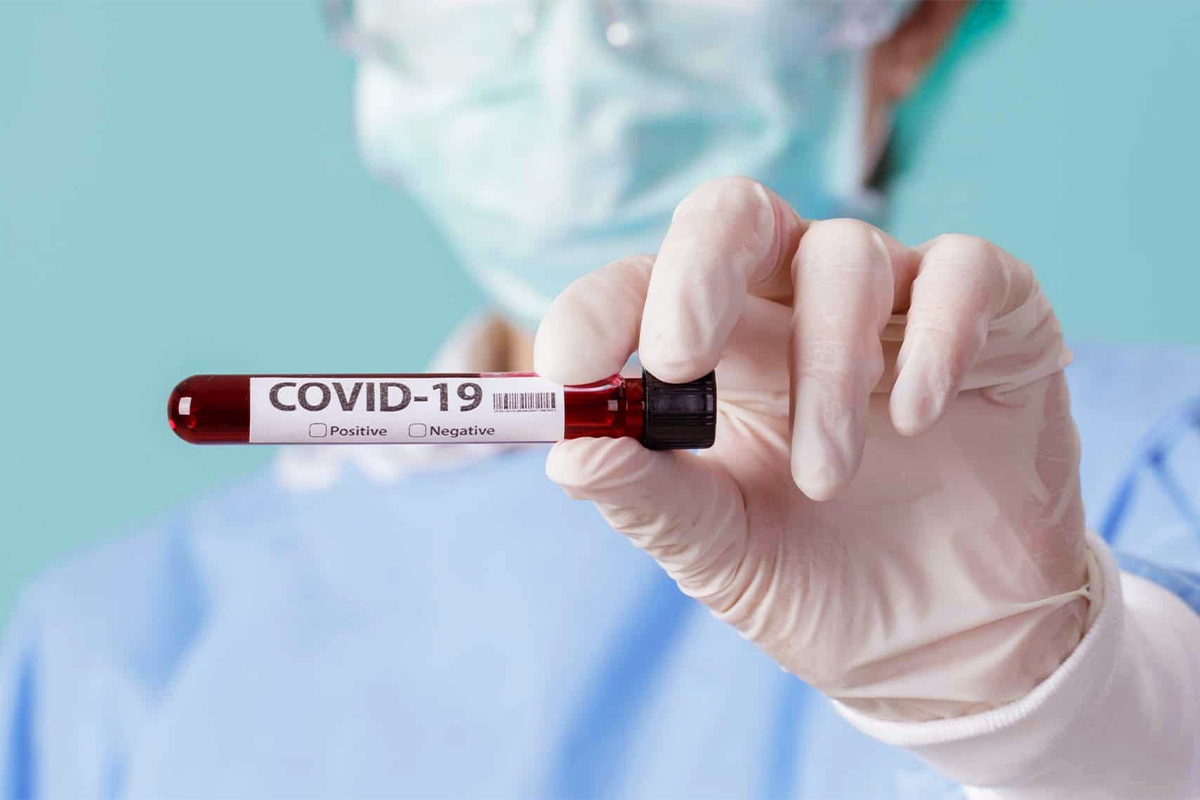 Anvisa afirma que Testes de sorologia não servem para avaliar proteção contra Covid-19
