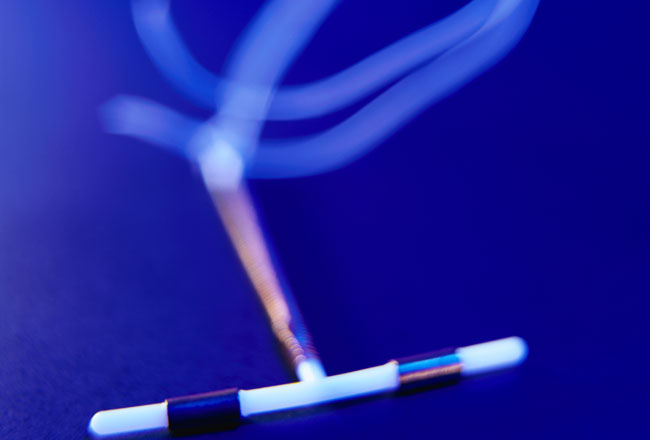 Em Salvador mulheres podem aderir gratuitamente ao DIU a partir desta terça ( 7)