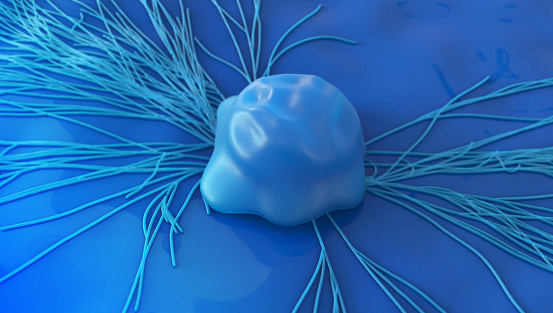 Pesquisadores descobrem terapia menos agressiva a pacientes com câncer cervical