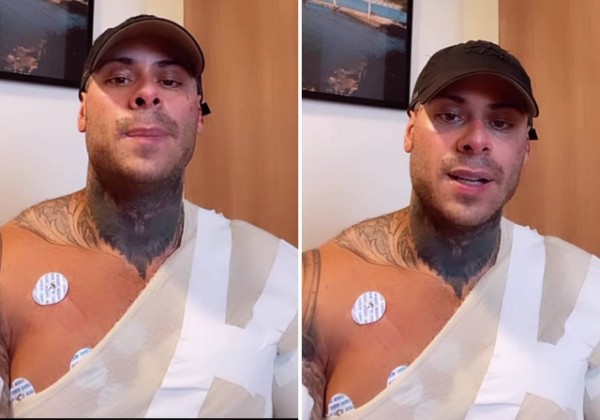 Léo Stronda sofre queimaduras e passa por cirurgias plásticas