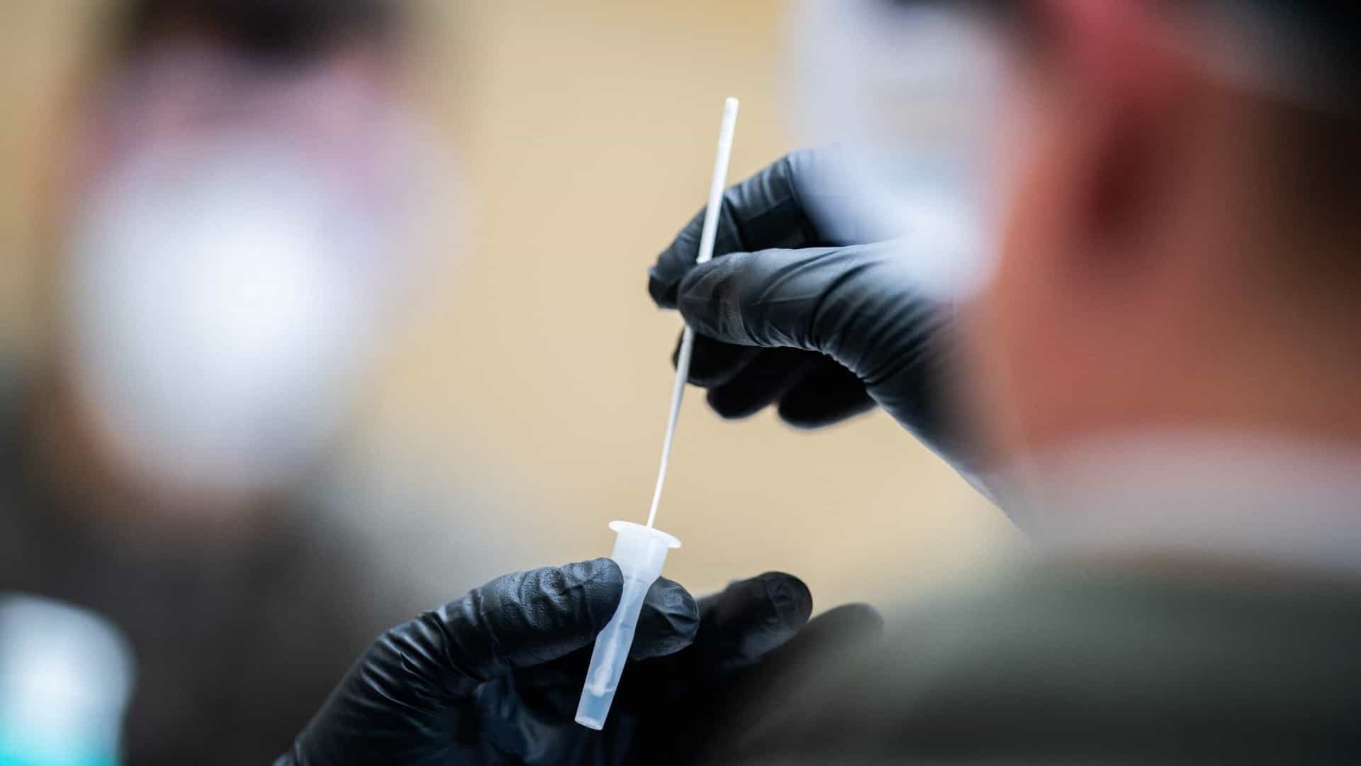 Hapvida orienta médicos a não pedir teste PCR para paciente com suspeita de Covid