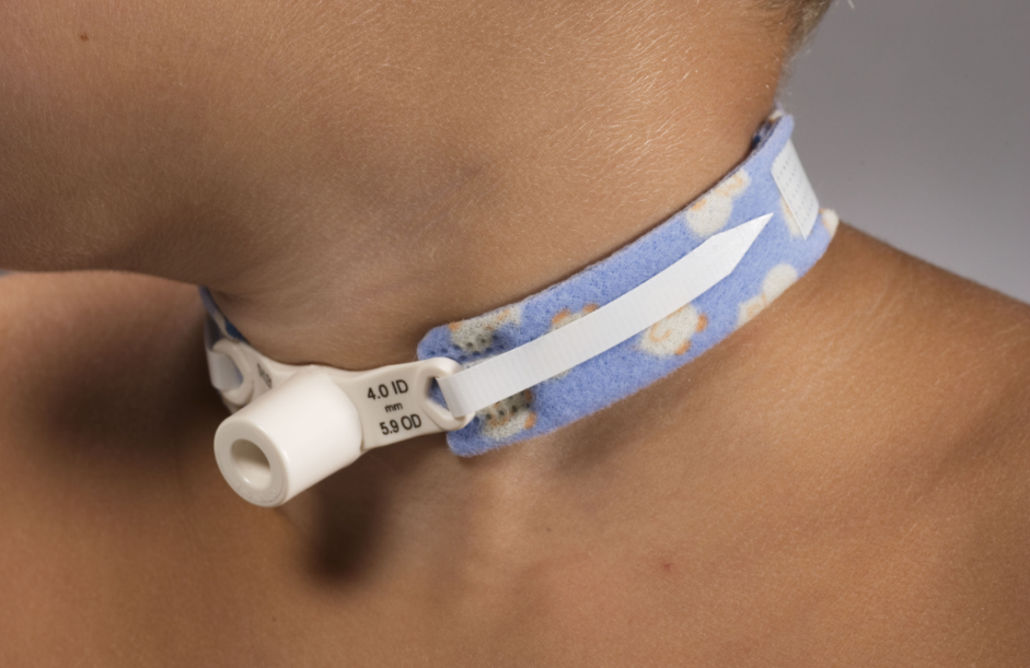 Publicada lei que cria o Dia Nacional da Criança Traqueostomizada