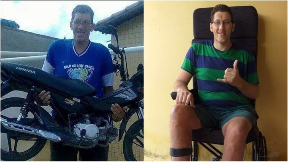 Homem mais alto do Brasil amputa perna em cirurgia com quase três horas