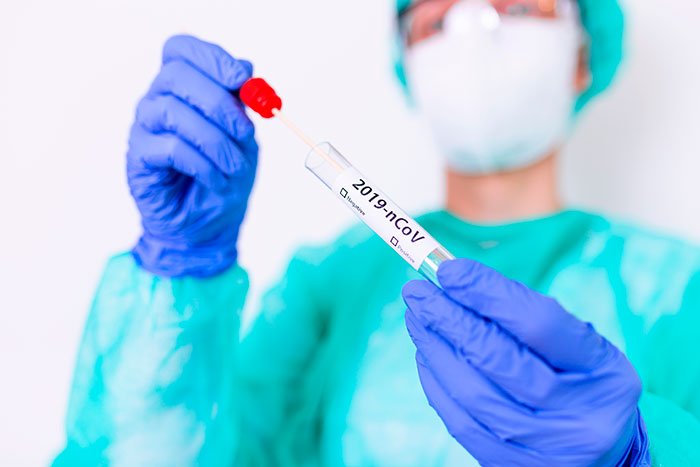 Anvisa proíbe kit de coleta para teste e diagnóstico de Covid-19 sem registro