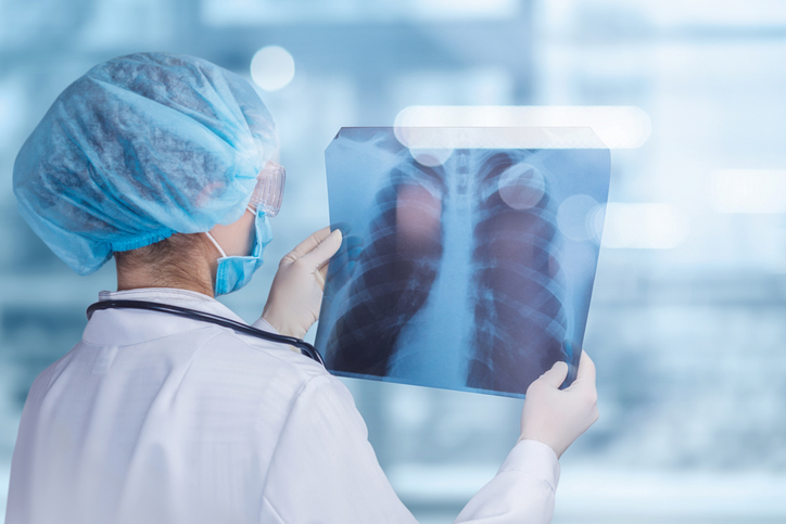 Paciente com câncer terminal sobrevive após transplante duplo de pulmões nos EUA