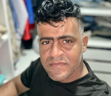 Homem morre após passar mal durante procedimento de implante capilar