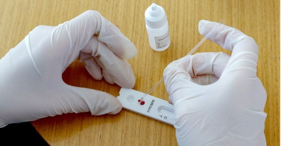 Casos de Covid sobem 82% em uma semana nas farmácias do Brasil