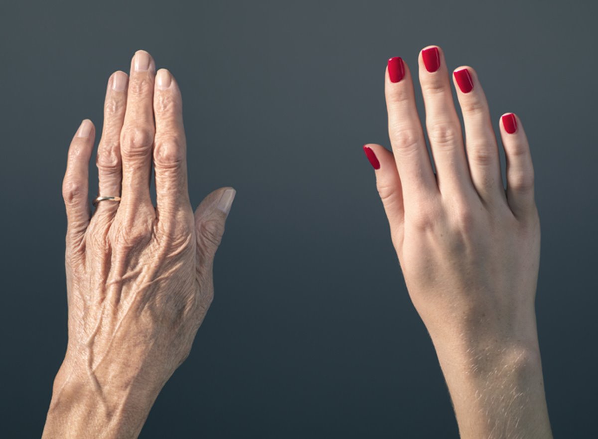 Cientistas rejuvenescem pela primeira vez pele de mulher em 30 anos, diz estudo