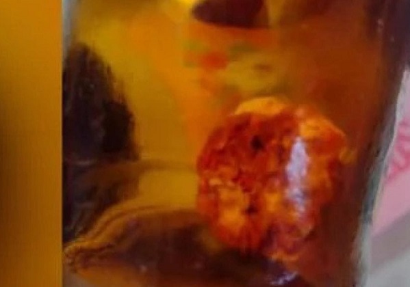 Homem diz ter encontrado ‘dedo’ dentro de garrafa de cerveja: ‘Tinha unha’