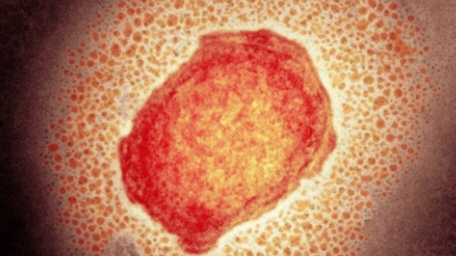 Confirmada primeira morte por varíola dos macacos nos Estados Unidos