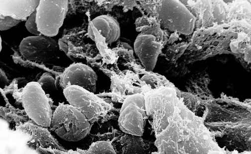 Análise de DNA achado no Quirguistão revela possível local de origem da Peste Negra