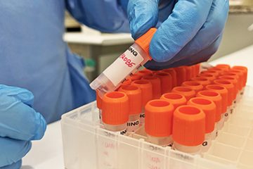 Saúde descarta suspeita de caso da varíola dos macacos na Bahia