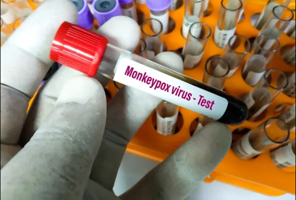 Varíola dos macacos entre comunidade LGBTQIA+ preocupam autoridades dos Estados Unidos