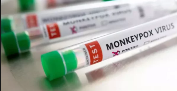 Salvador tem novos casos de Monkeypox e Bahia chega a 44 infectados