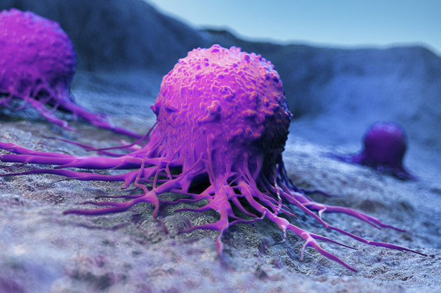 Mortes por câncer aumentaram durante a pandemia, afirma especialista