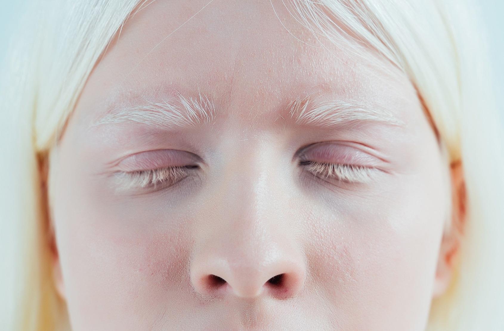 Bahia vai implantar linha de cuidado à saúde integral das pessoas com albinismo