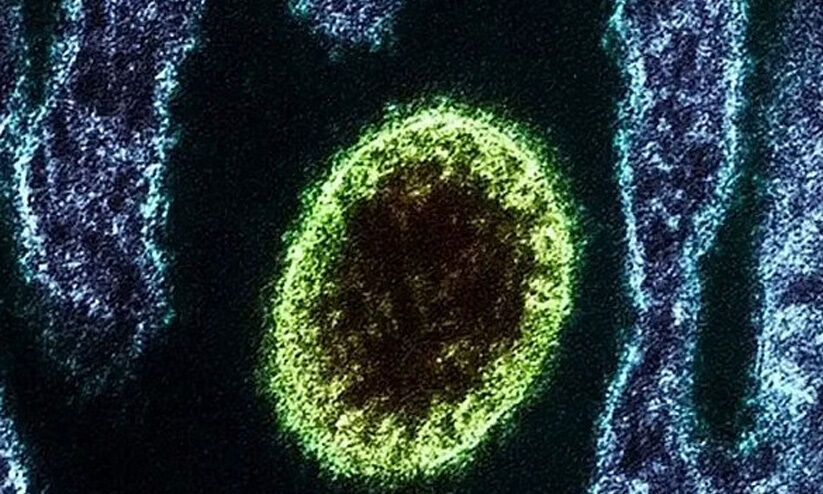 China já tem 35 pessoas infectadas com novo vírus Langya Henipavirus