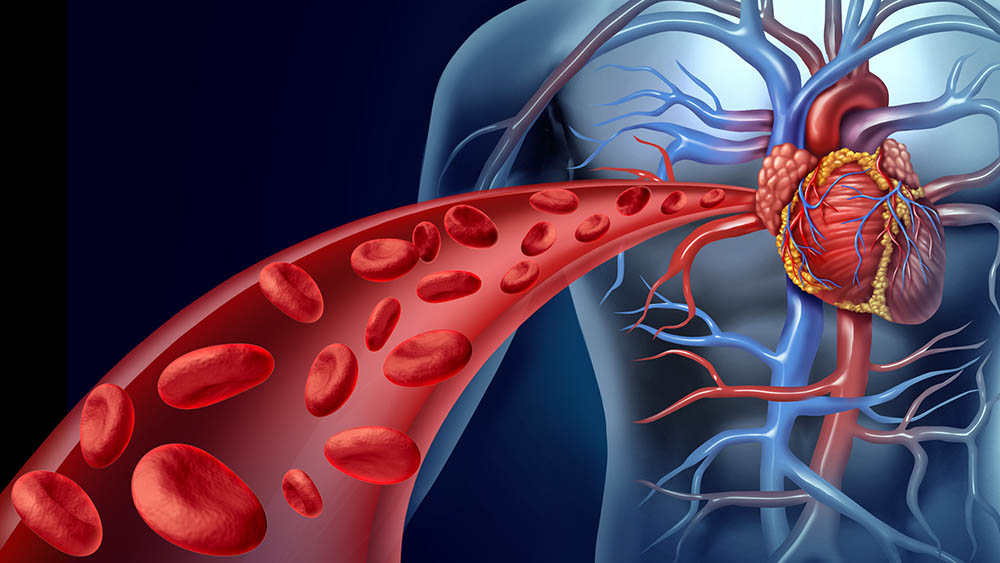 Impacto do acúmulo de gordura nas artérias é maior em pessoas brancas, aponta estudo