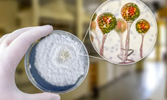 Pacientes com infecções fúngicas terão novas opções de tratamento pelo SUS