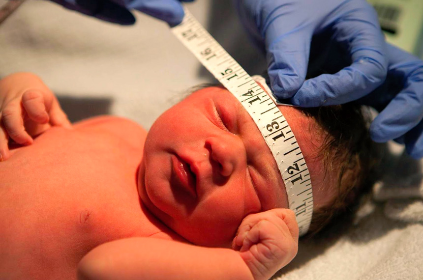 Mutirão de Saúde para associados Abraço a Microcefalia acontece nesta sexta (22)