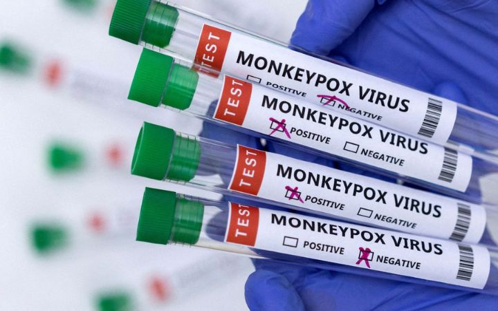 Anvisa aprova registro de 1º teste para varíola dos macacos