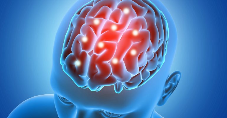 Vacina que protege contra a gripe pode reduzir risco de AVC, aponta estudo