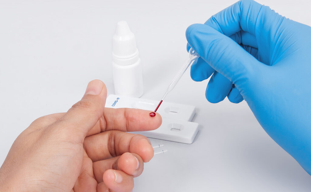 Ação especial de saúde no Dezembro Vermelho acontece nesta sexta (1º)