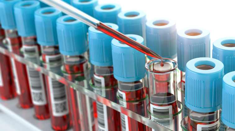 Amostras de sangue podem ser usadas para monitorar evolução de epidemias, aponta estudo