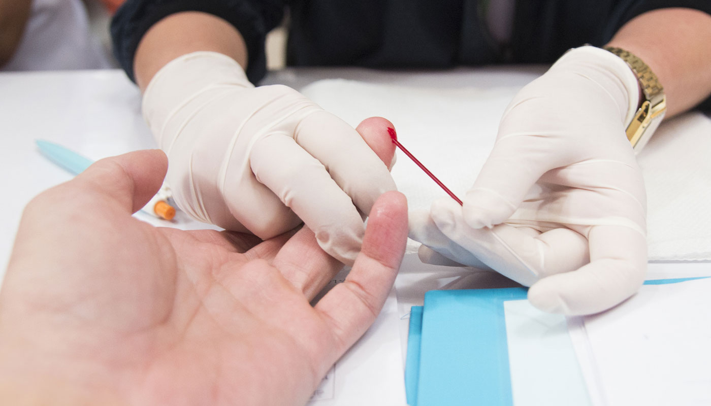 Brasil atinge uma das três metas da ONU para acabar com epidemia de HIV/Aids