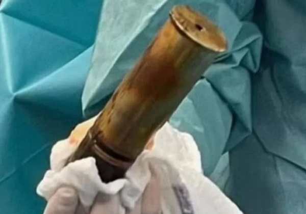 Hospital é evacuado após idoso chegar ao local com bomba no ânus