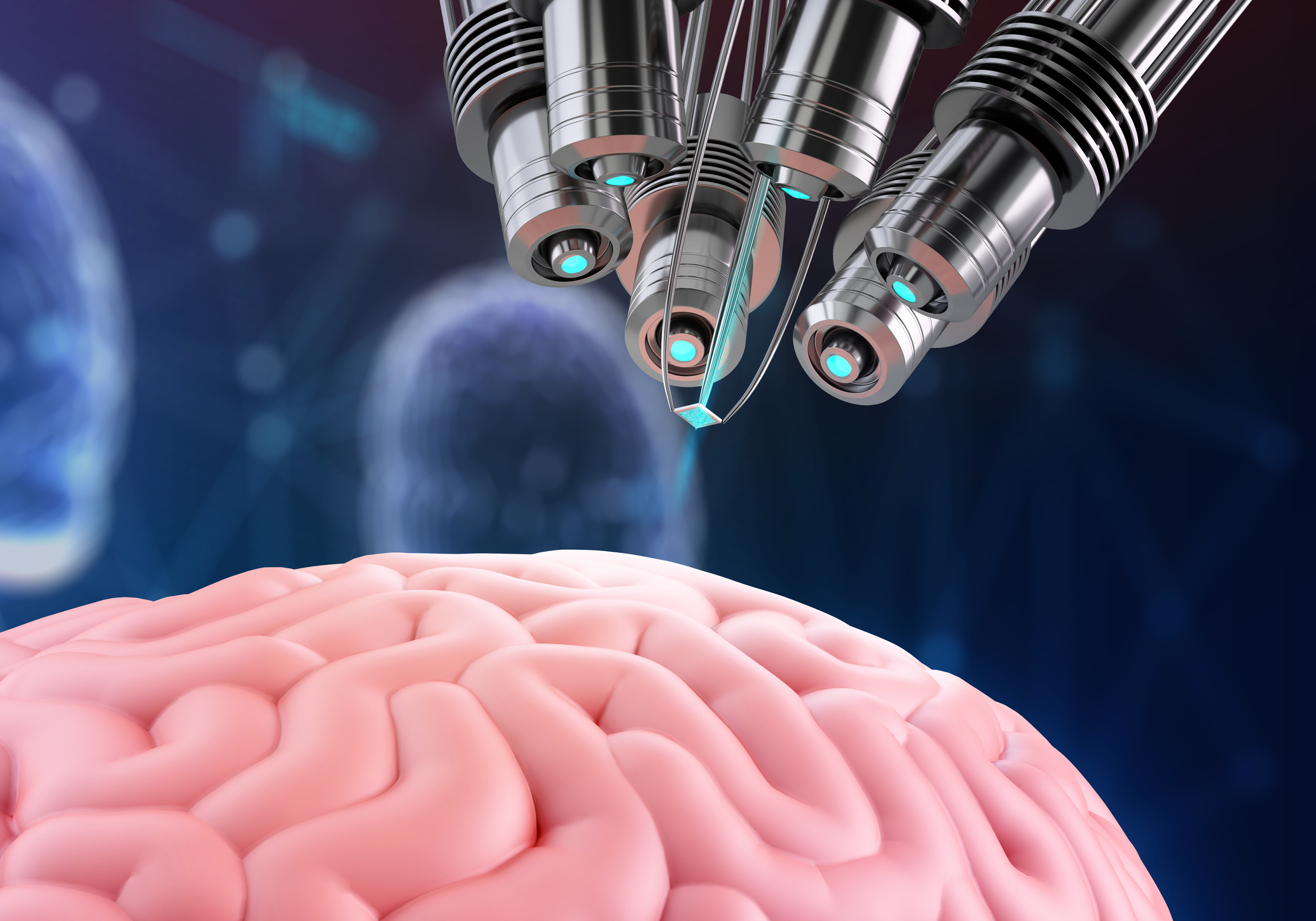 Elon Musk diz que chips cerebrais podem ser implantados em humanos dentro de seis meses