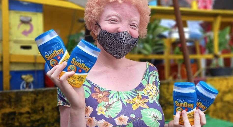 Saúde realiza distribuição de protetor solar para comunidade de albinos