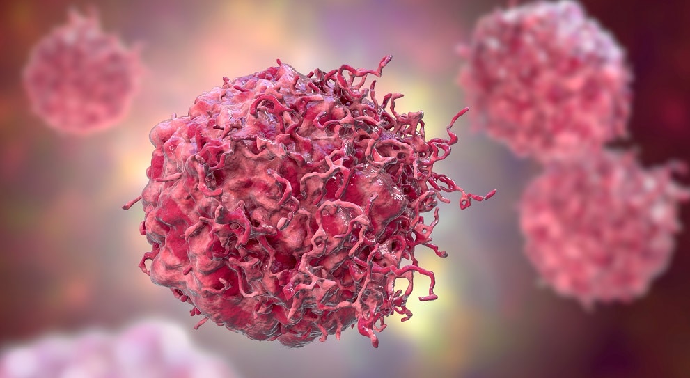 Dados do INCA apontam 704 mil novos casos de câncer no Brasil em 2023