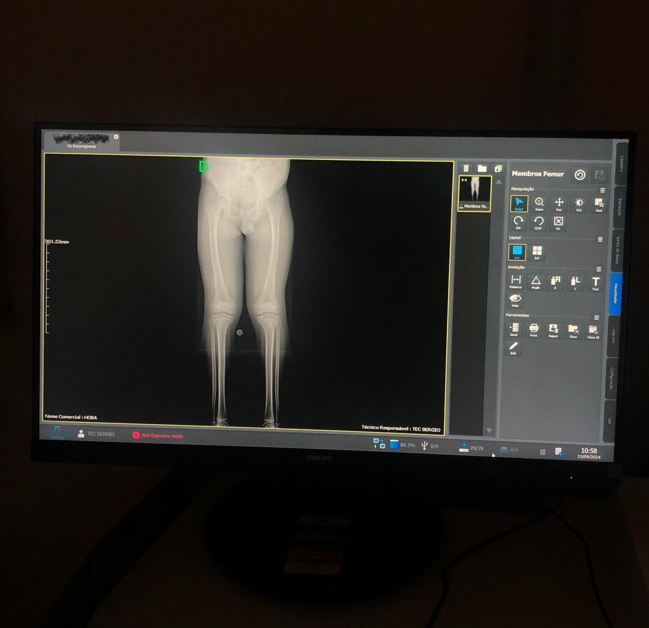 Hospital Ortopédico da Bahia disponibiliza exame inédito no SUS; confira