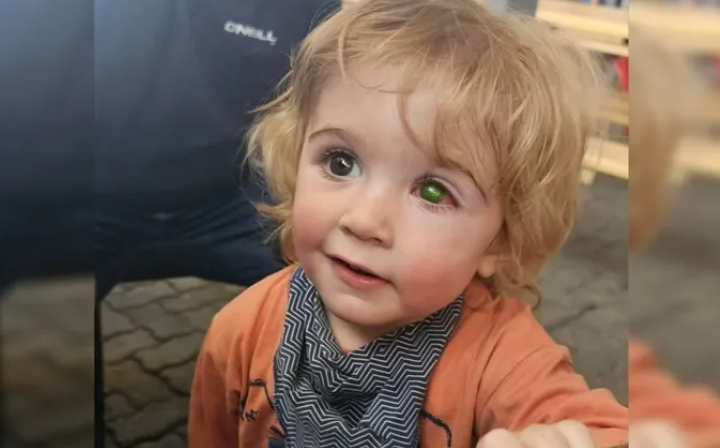 Menino de 2 anos perde visão após ser beijada por pessoa com herpes labial