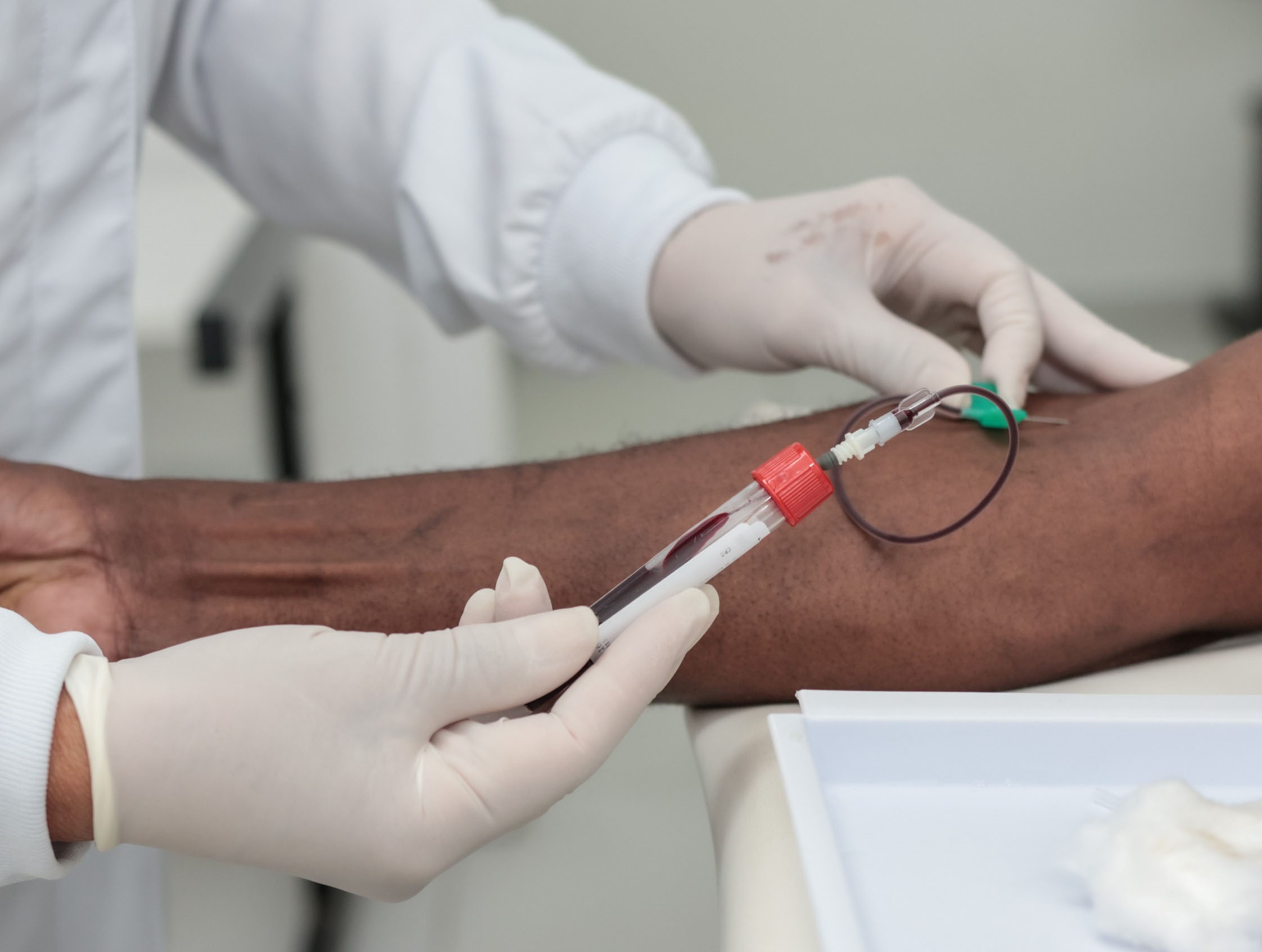 INAC realiza mutirão de dosagem de creatinina para marcar o Dia do Rim